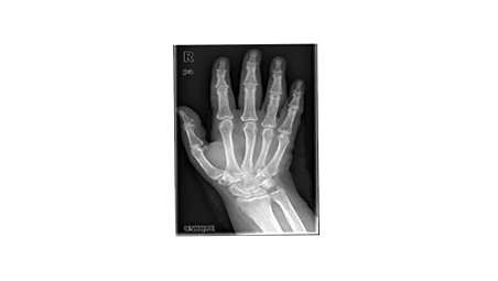MobileDiagnost Opta