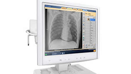 MobileDiagnost Opta