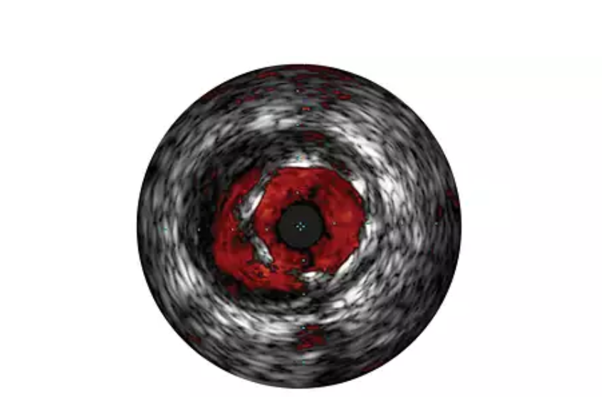 Volcano Core Mobile