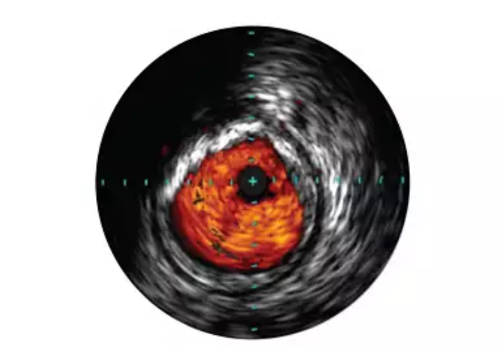 Volcano Core Integrated