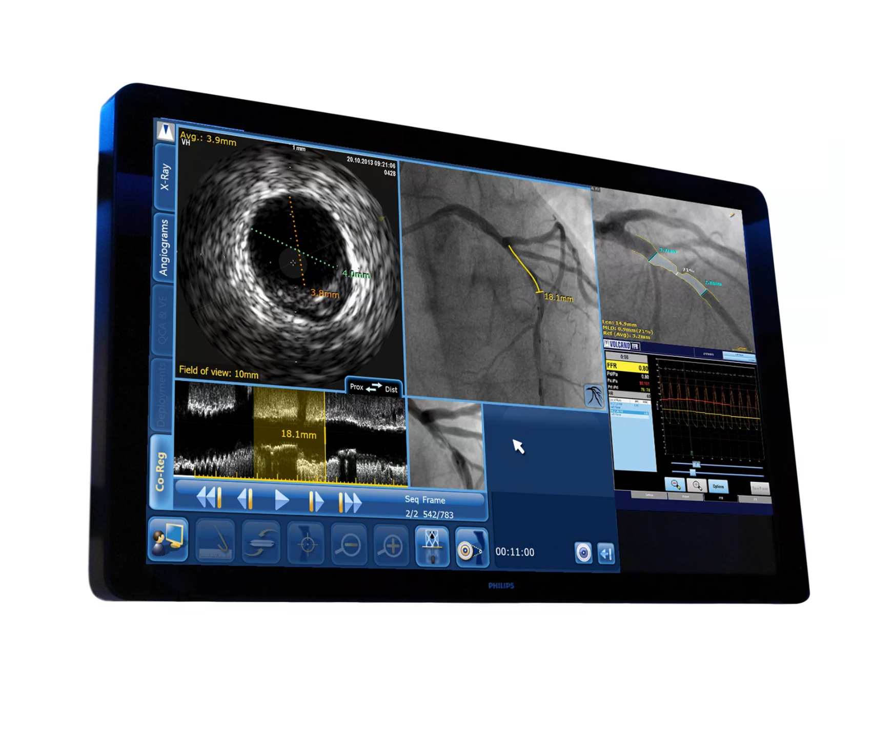 SyncVision