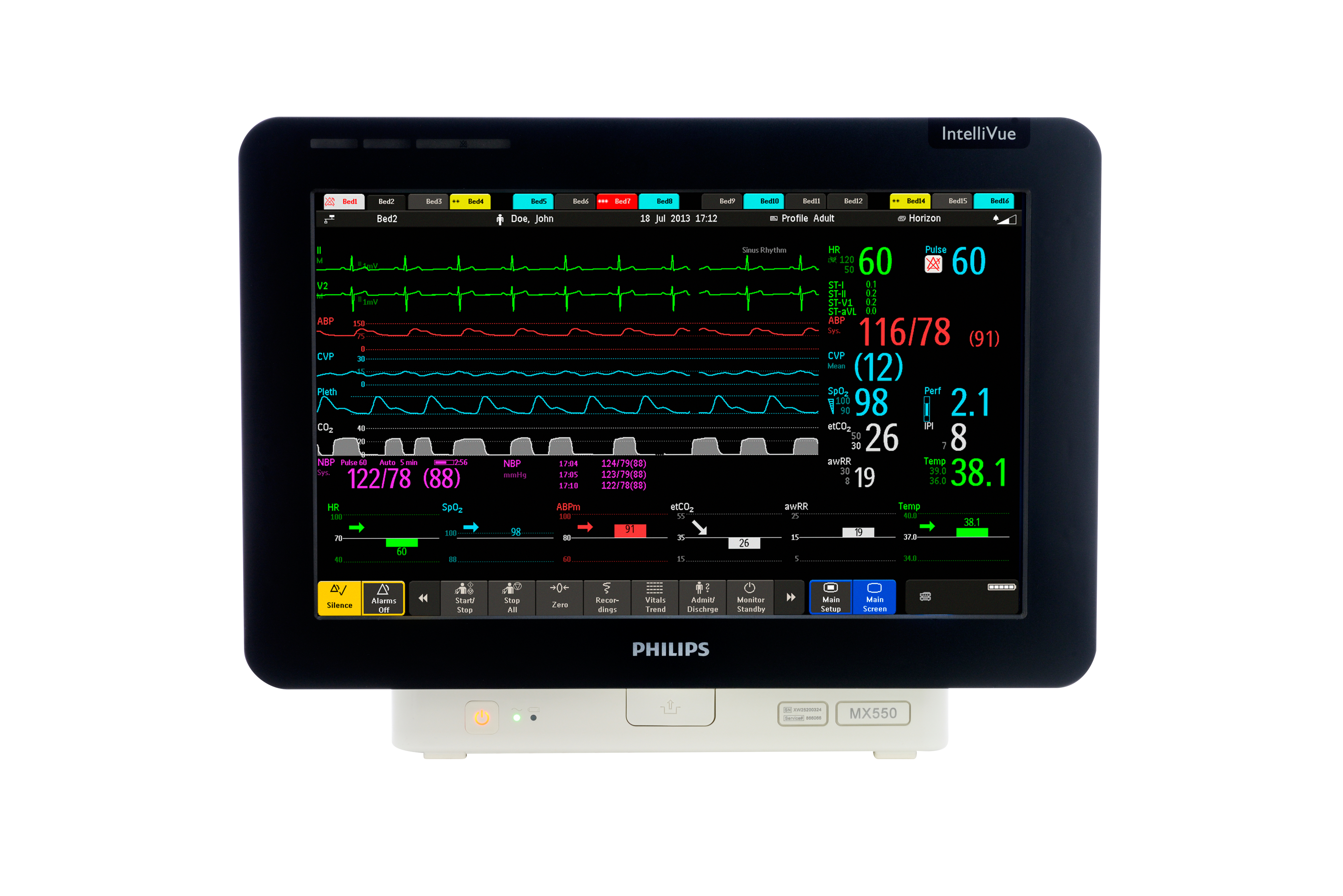 Монитор пациента IntelliVue MX550